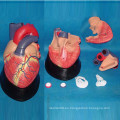 Anatomía del corazón humano Modelo médico para la enseñanza (R120102)